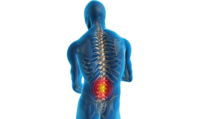 स्लिप डिस्क