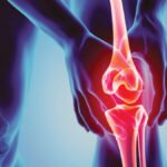 Arthritis causes types and treatment