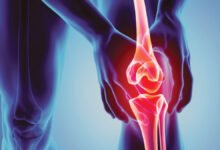 Arthritis causes types and treatment