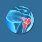 how to cure knee pain